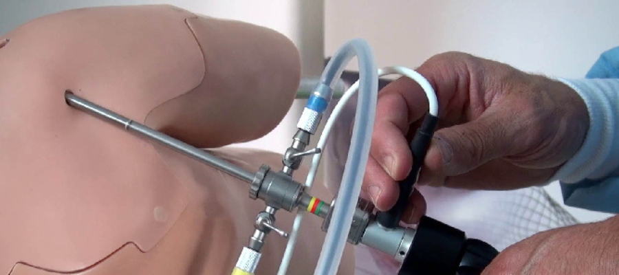 Shoulder Arthroscopy
