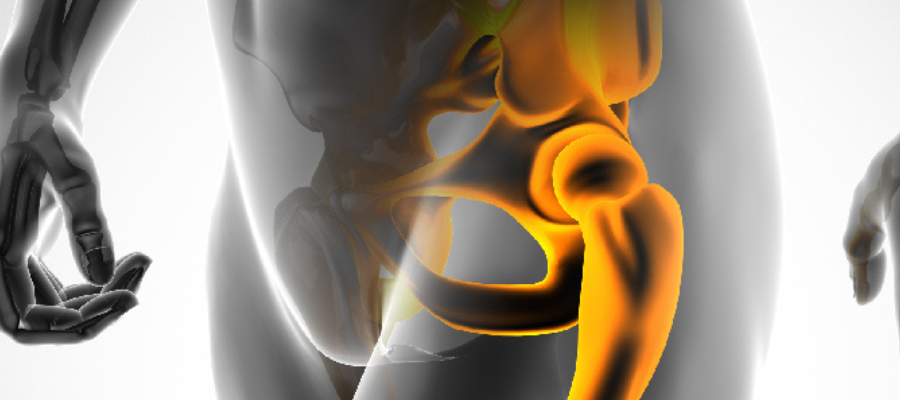 Total Hip Replacement